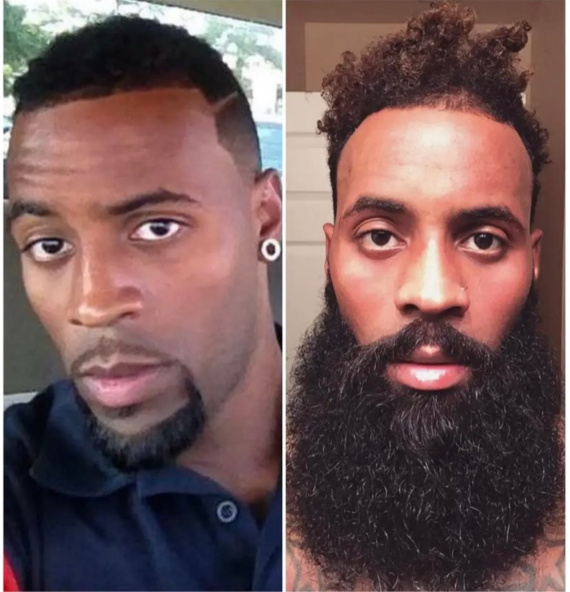 Complete Beard Growth Combo