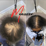 Movatte Ultimate Hair Growth Bundle